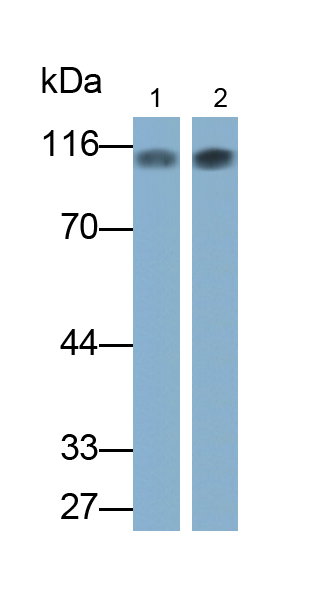 Monoclonal Antibody to Promyelocytic Leukemia Protein (PML)