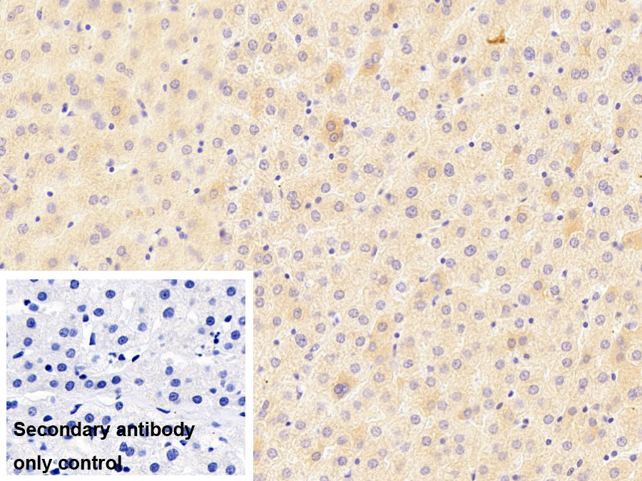 Monoclonal Antibody to Promyelocytic Leukemia Protein (PML)