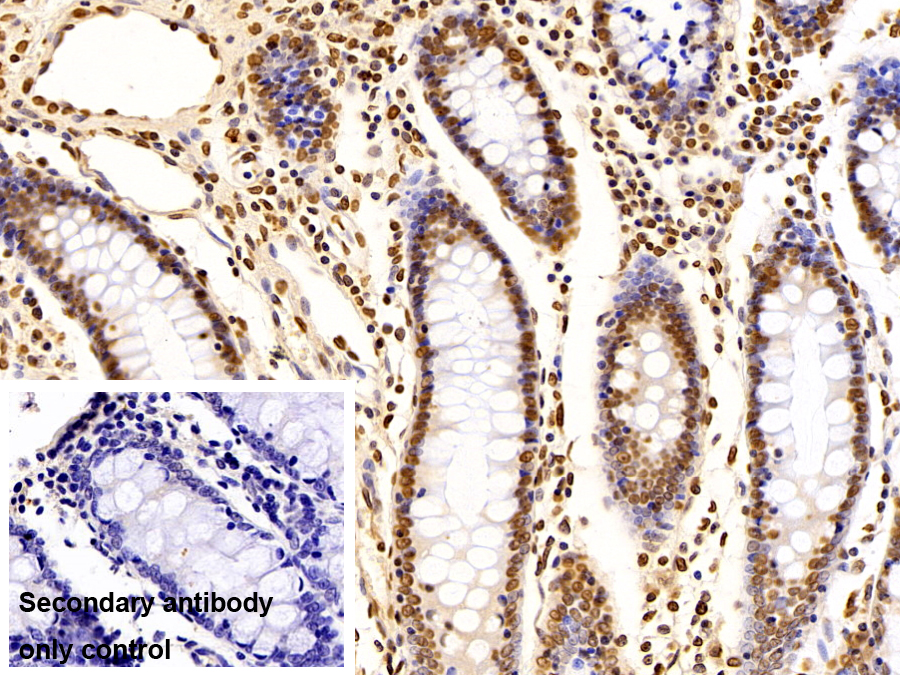 Monoclonal Antibody to Promyelocytic Leukemia Protein (PML)