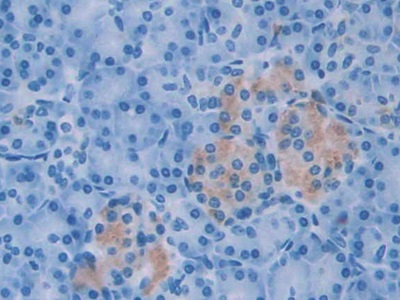 Monoclonal Antibody to Anterior Gradient 2 (AGR2)