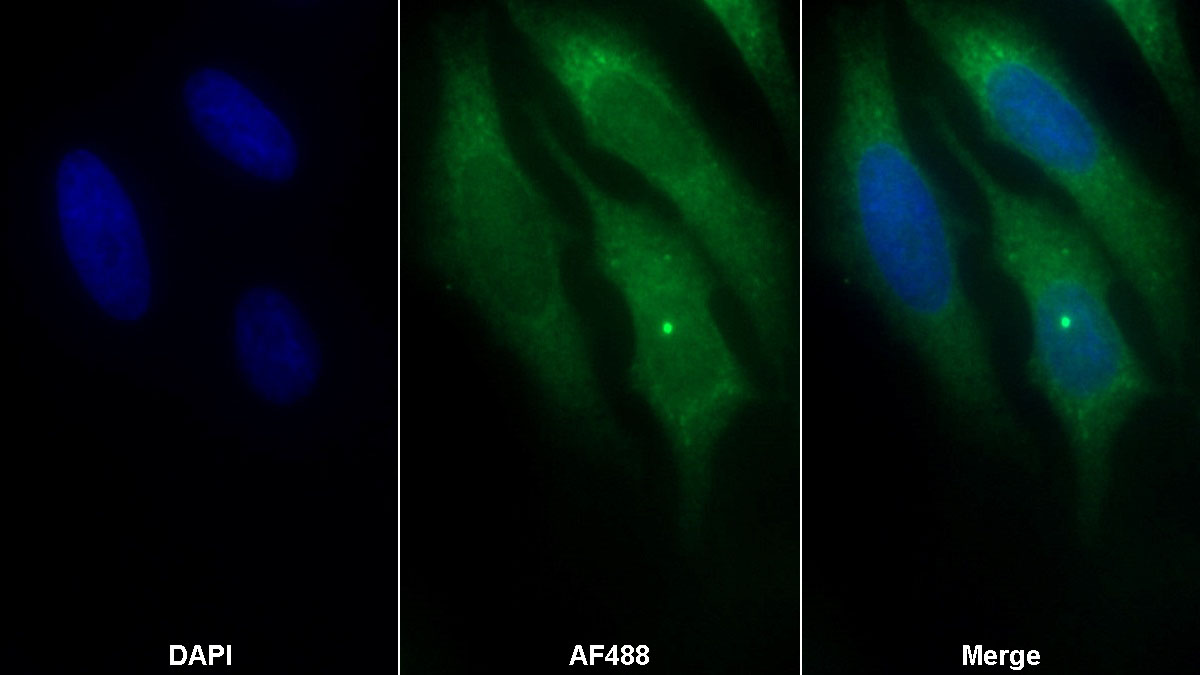 Monoclonal Antibody to Mesencephalic Astrocyte Derived Neurotrophic Factor (MANF)