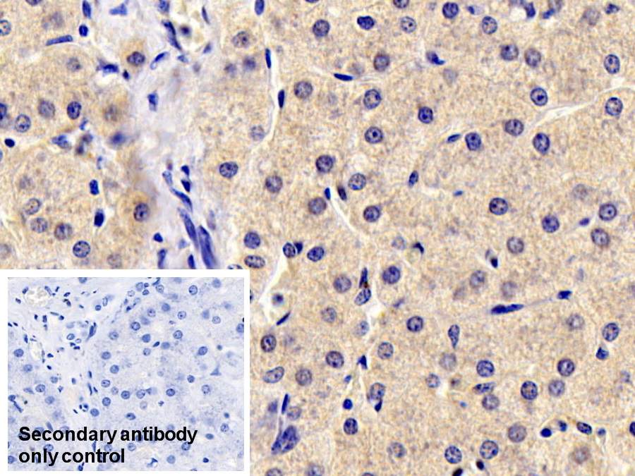 Monoclonal Antibody to Antithrombin (AT)