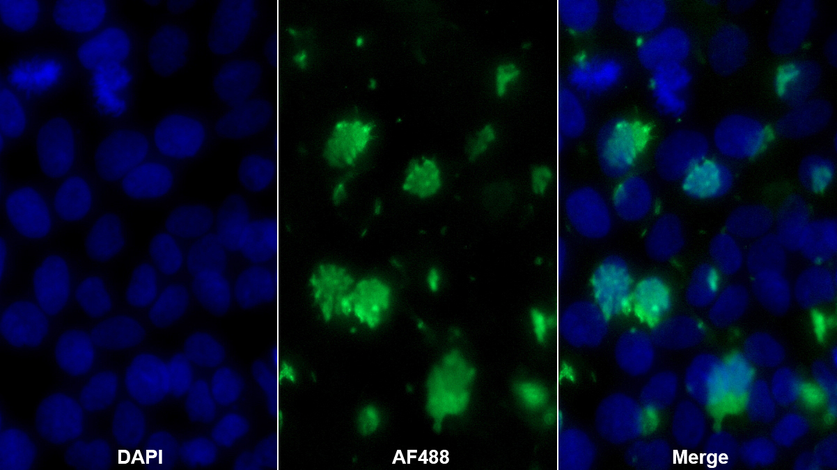 Monoclonal Antibody to Argininosuccinate Synthetase 1 (ASS1)