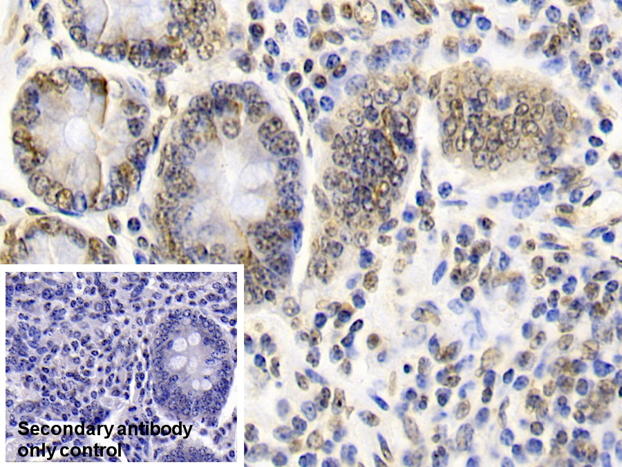 Monoclonal Antibody to Caspase 6 (CASP6)