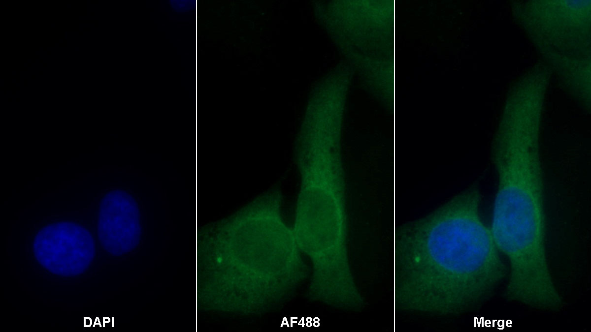 Monoclonal Antibody to Caspase 6 (CASP6)