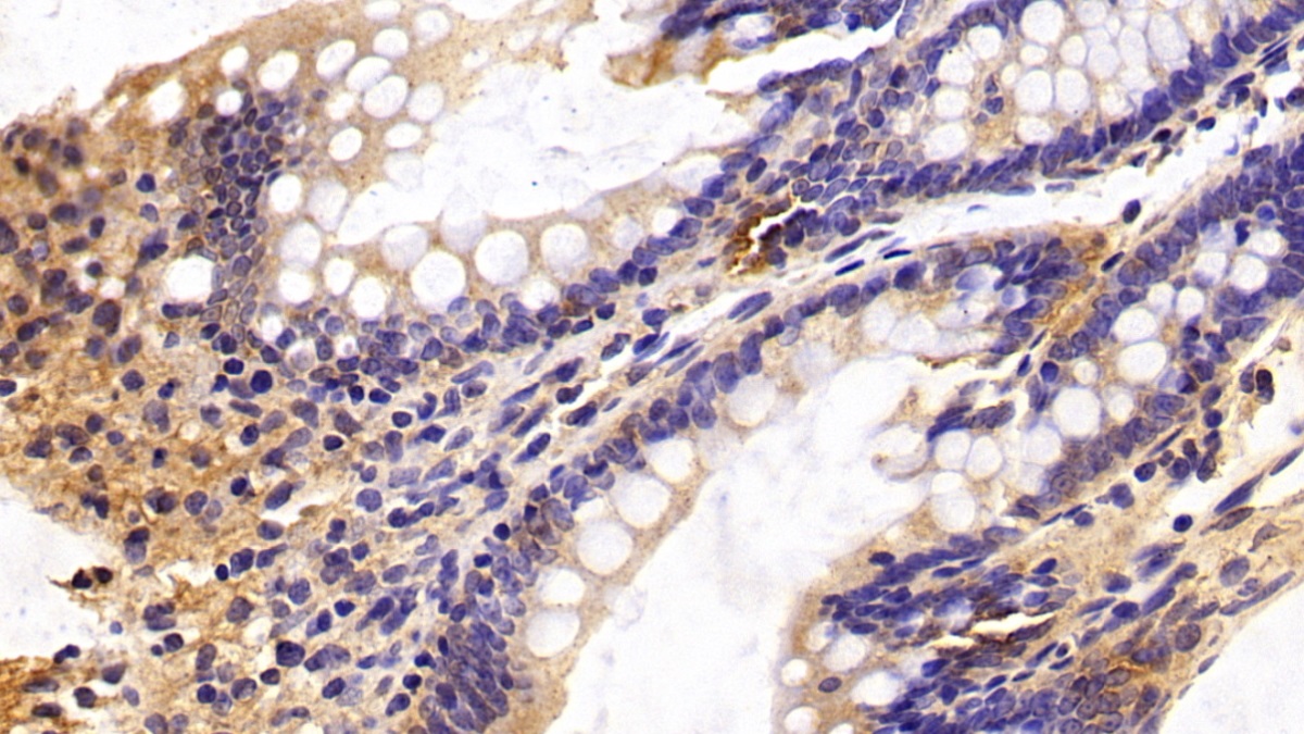 Monoclonal Antibody to Caspase 6 (CASP6)