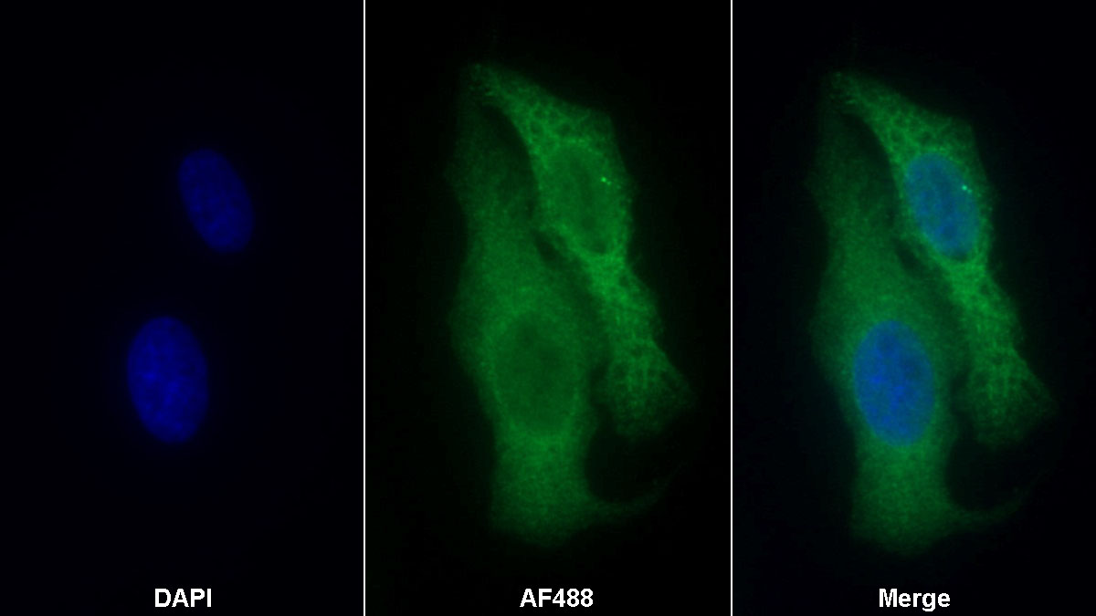 Monoclonal Antibody to Caspase 6 (CASP6)