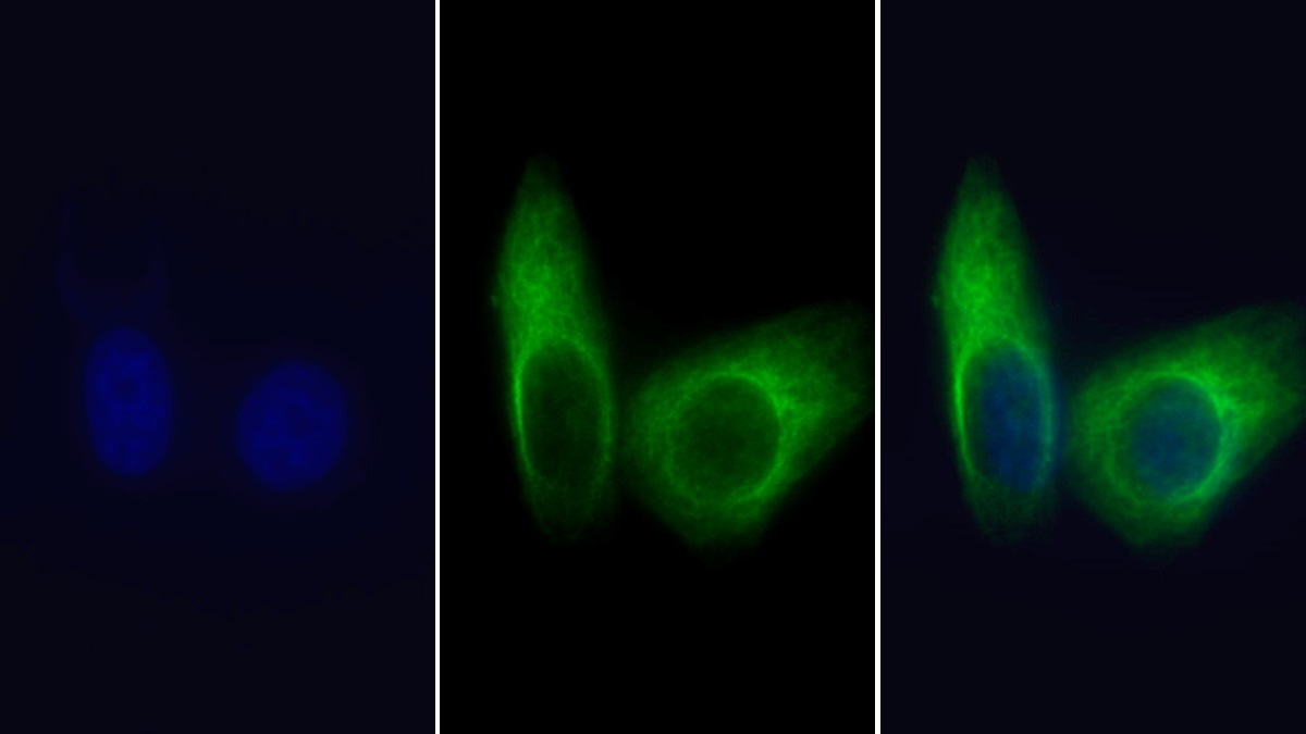 Monoclonal Antibody to Heat Shock 70kDa Protein 5 (HSPA5)