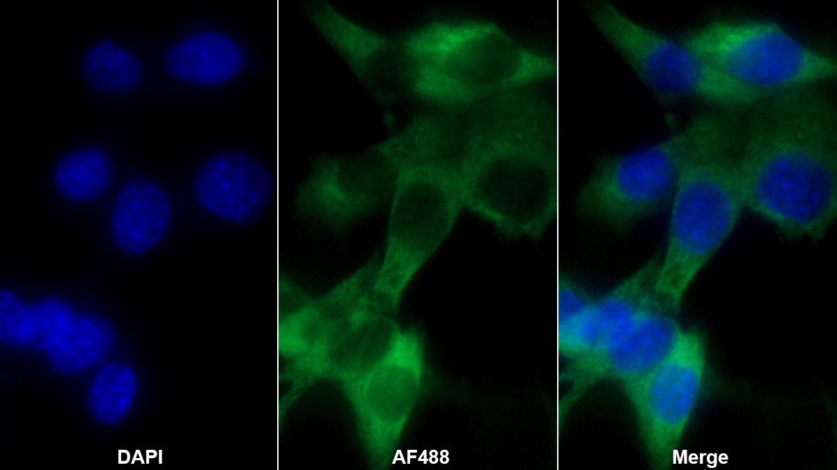Monoclonal Antibody to Heat Shock 70kDa Protein 5 (HSPA5)