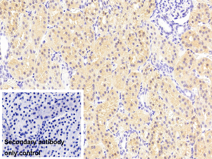 Monoclonal Antibody to Carbonyl Reductase 1 (CBR1)
