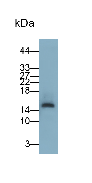 Monoclonal Antibody to Charcot Leyden Crystal Protein (CLC)