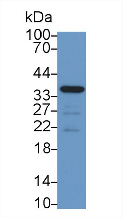 Monoclonal Antibody to Corticotropin Releasing Hormone Binding Protein (CRHBP)