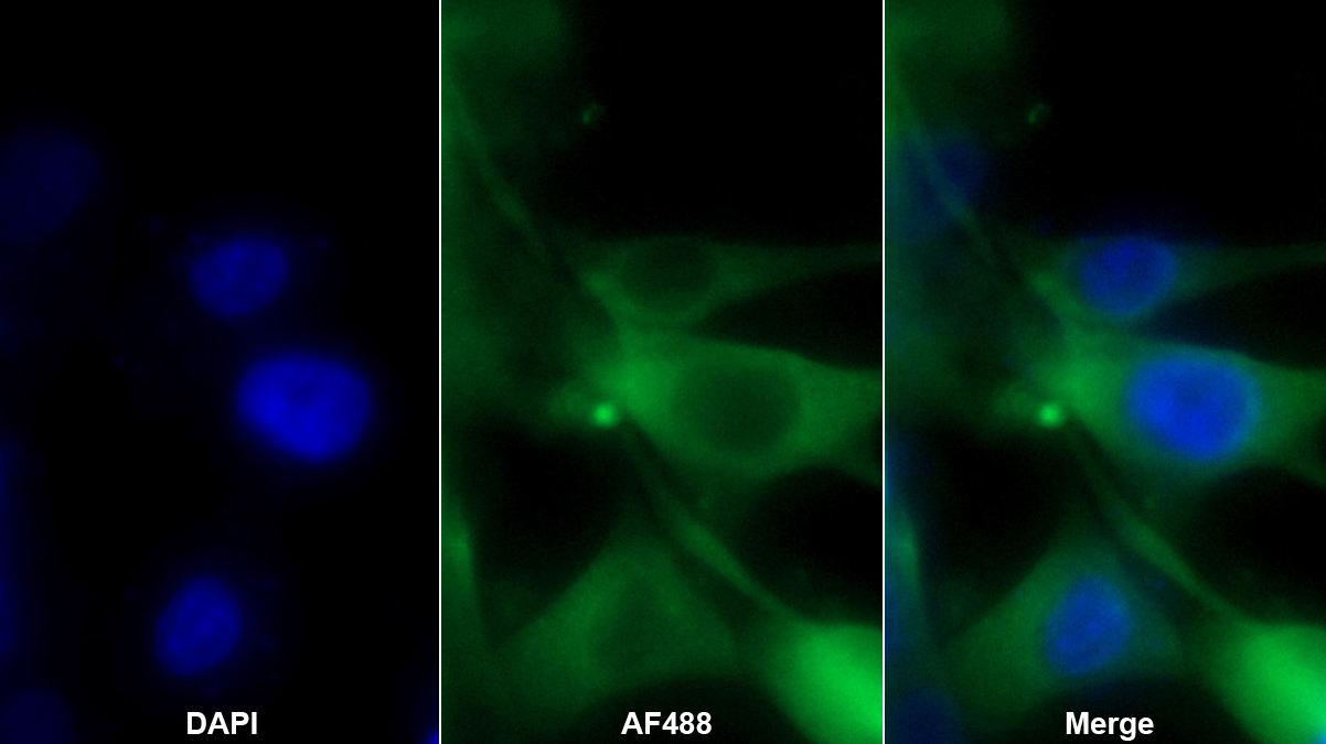 Monoclonal Antibody to Corticotropin Releasing Hormone Binding Protein (CRHBP)