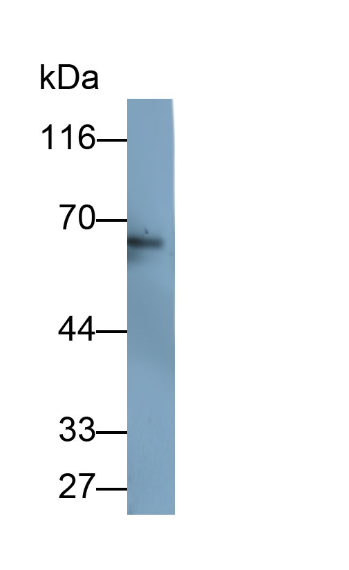 Monoclonal Antibody to Catalase (CAT)