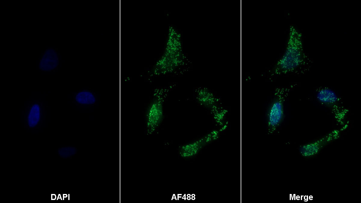 Monoclonal Antibody to Catalase (CAT)