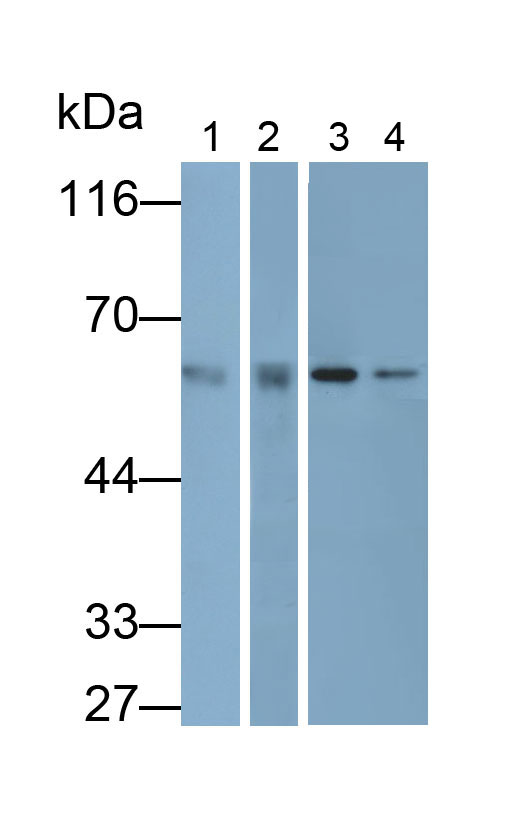 Monoclonal Antibody to Catalase (CAT)