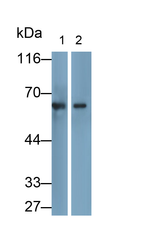 Monoclonal Antibody to Catalase (CAT)