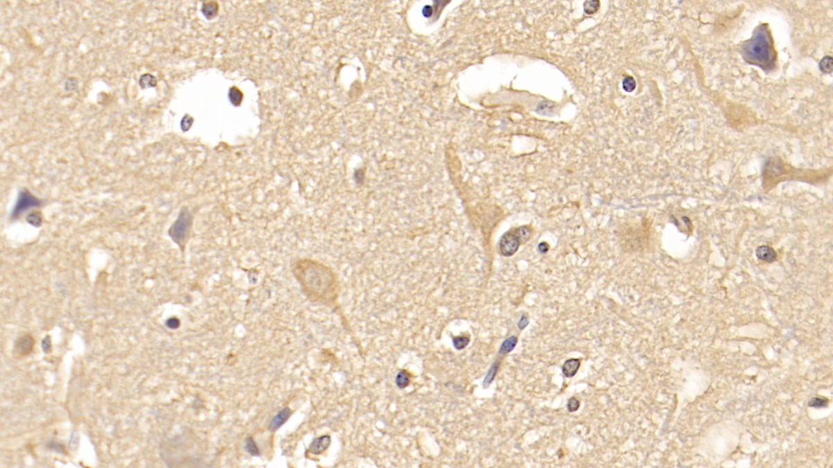 Monoclonal Antibody to Fibroblast Activation Protein Alpha (FAPa)