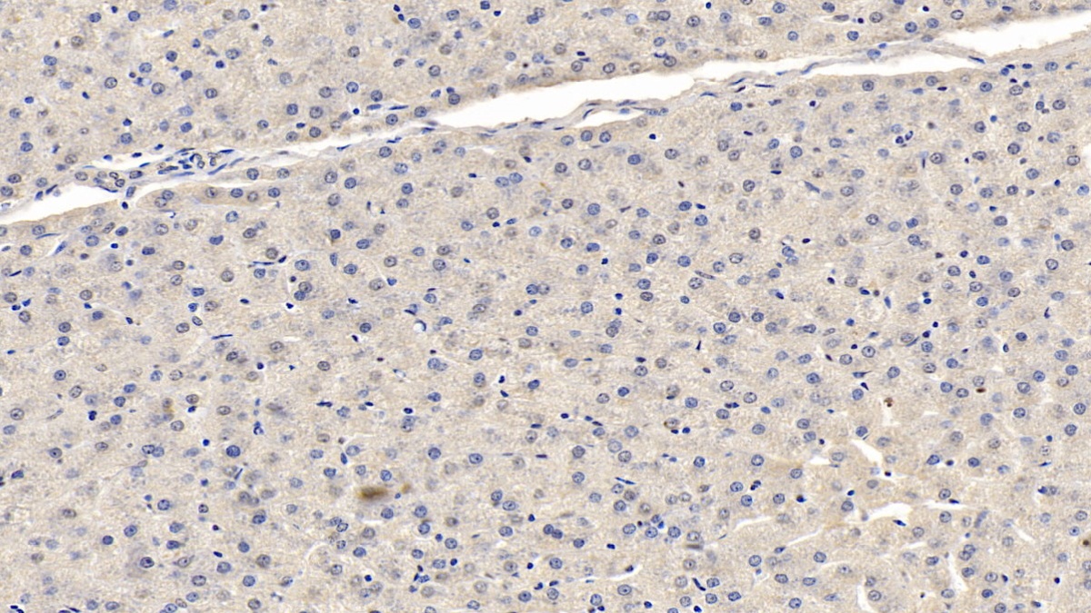 Monoclonal Antibody to Fibroblast Activation Protein Alpha (FAPa)