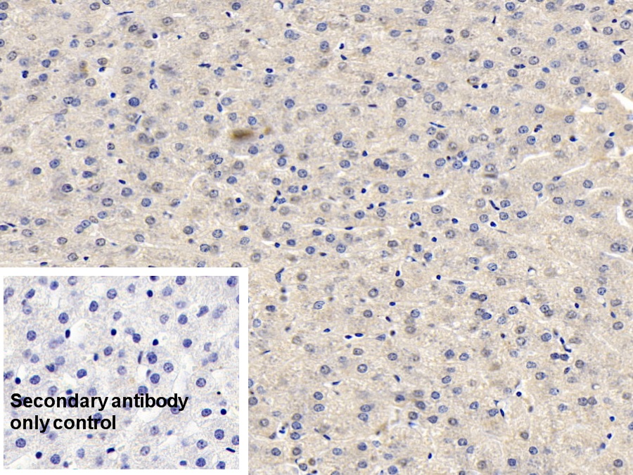 Monoclonal Antibody to Fibroblast Activation Protein Alpha (FAPa)