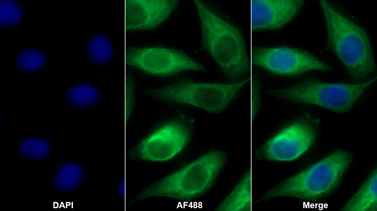 Monoclonal Antibody to Fibroblast Activation Protein Alpha (FAPa)