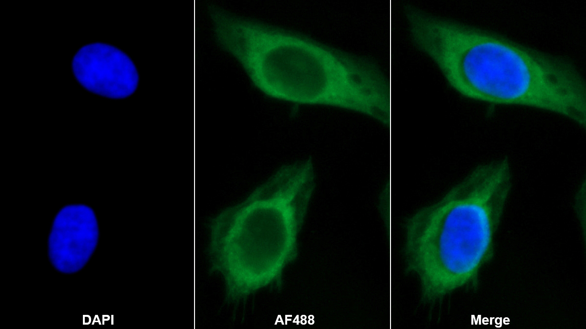 Monoclonal Antibody to Fibulin 1 (FBLN1)