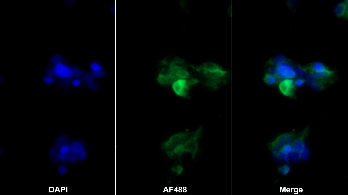 Monoclonal Antibody to Ferroportin (FPN)