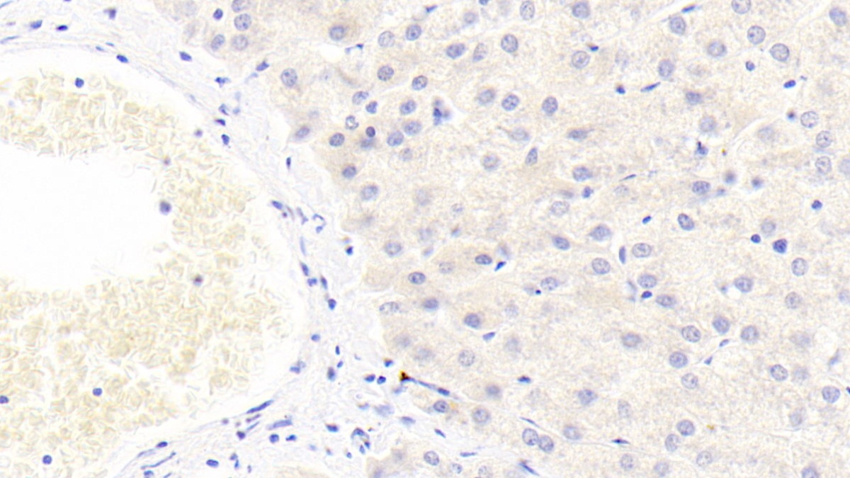 Monoclonal Antibody to Histidine Rich Glycoprotein (HRG)