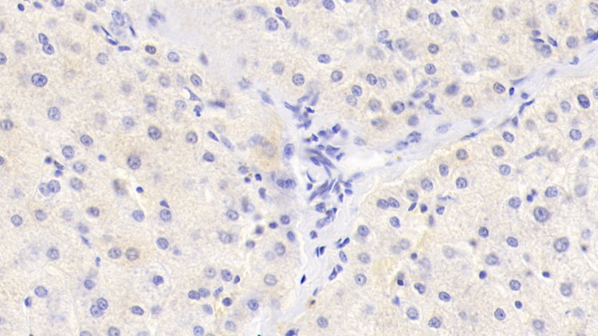 Monoclonal Antibody to Histidine Rich Glycoprotein (HRG)