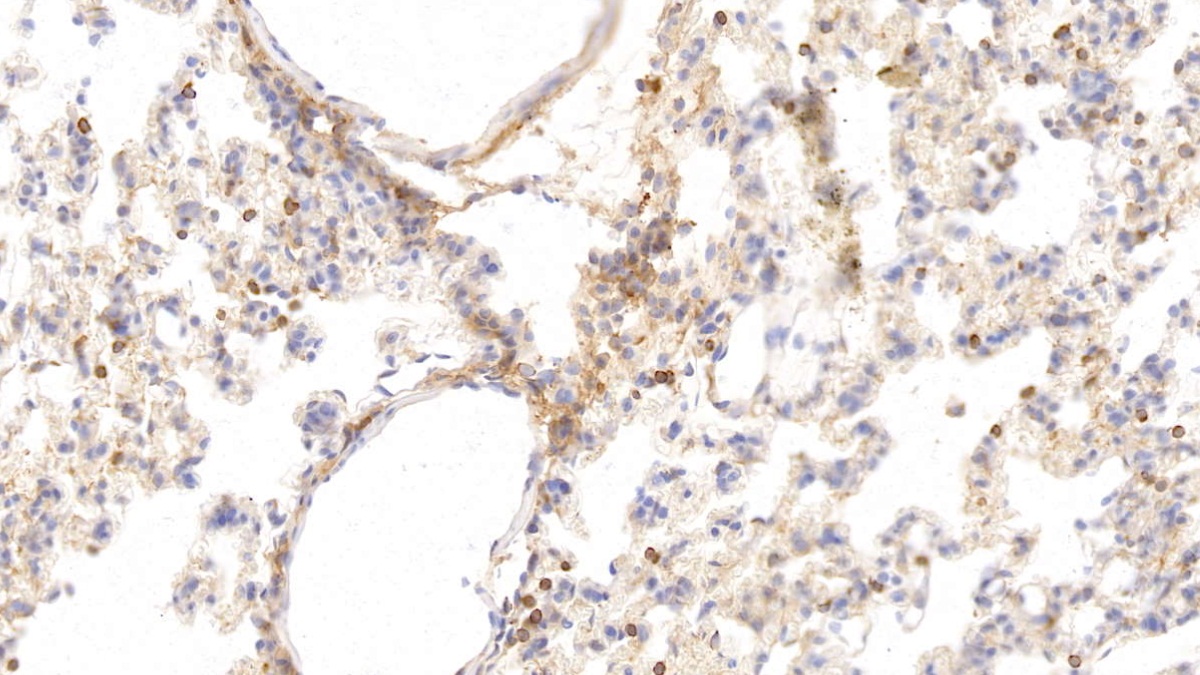 Monoclonal Antibody to Histidine Rich Glycoprotein (HRG)