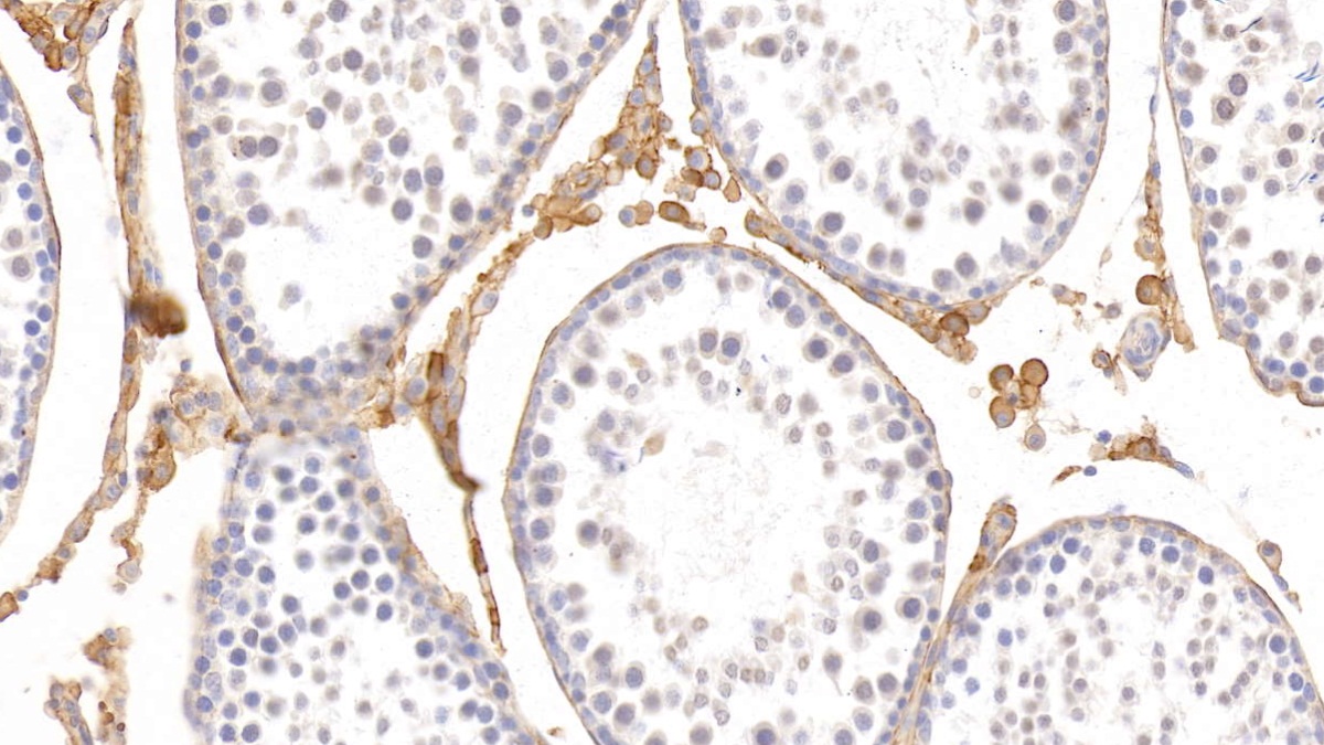 Monoclonal Antibody to Histidine Rich Glycoprotein (HRG)