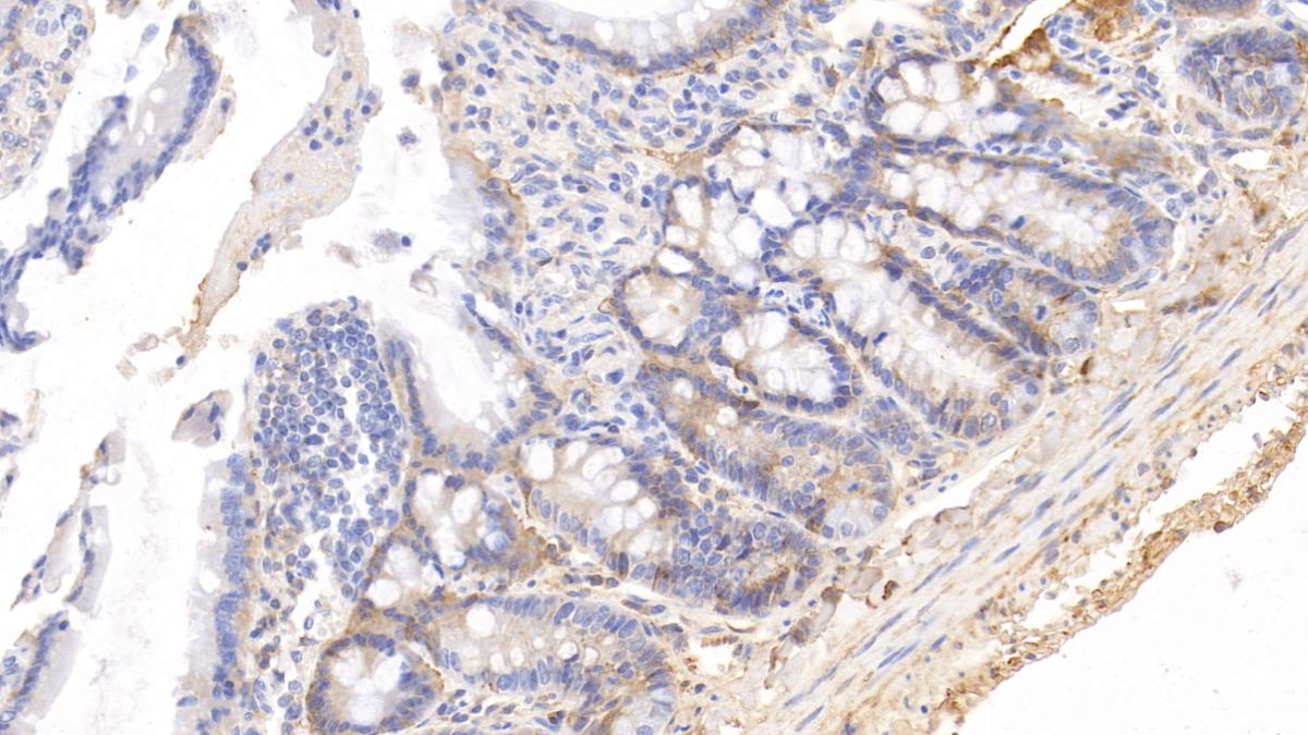 Monoclonal Antibody to Histidine Rich Glycoprotein (HRG)