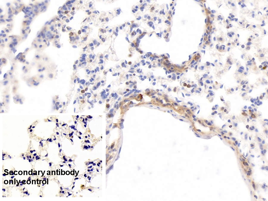 Monoclonal Antibody to Histidine Rich Glycoprotein (HRG)