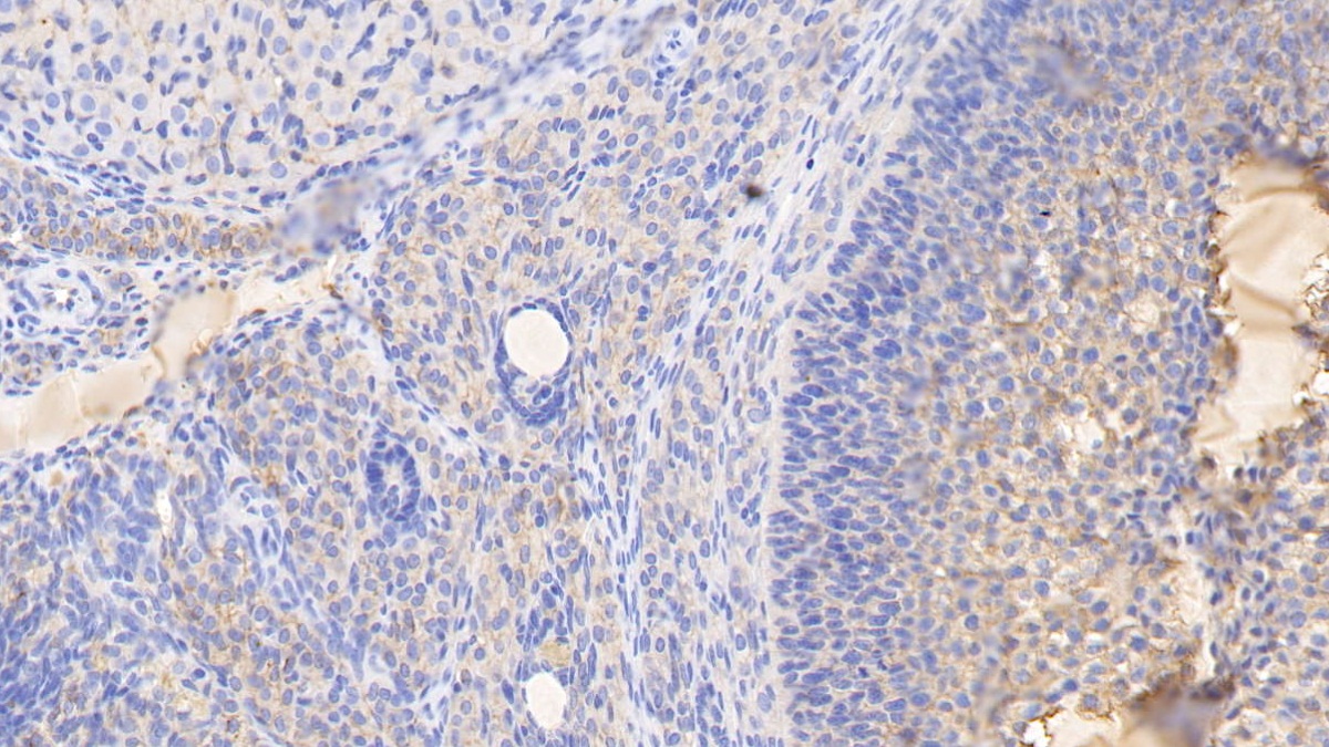 Monoclonal Antibody to Histidine Rich Glycoprotein (HRG)