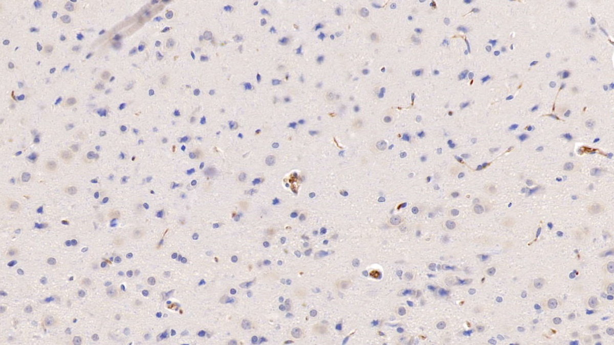 Monoclonal Antibody to Histidine Rich Glycoprotein (HRG)