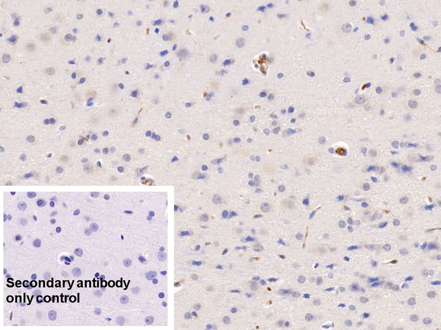 Monoclonal Antibody to Histidine Rich Glycoprotein (HRG)