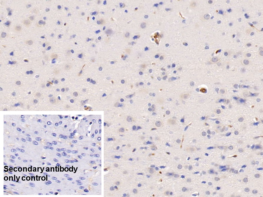 Monoclonal Antibody to Histidine Rich Glycoprotein (HRG)