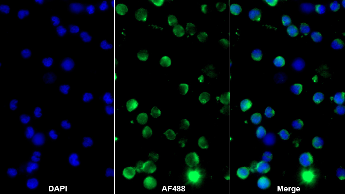 Monoclonal Antibody to L-Plastin (LCP1)