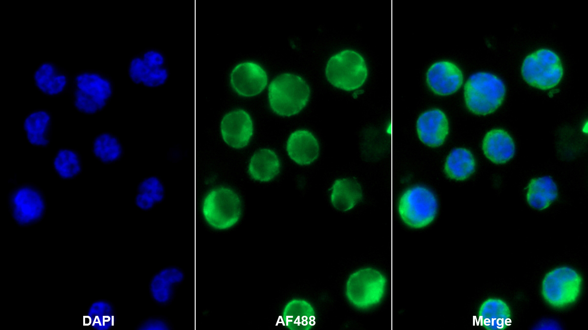 Monoclonal Antibody to L-Plastin (LCP1)