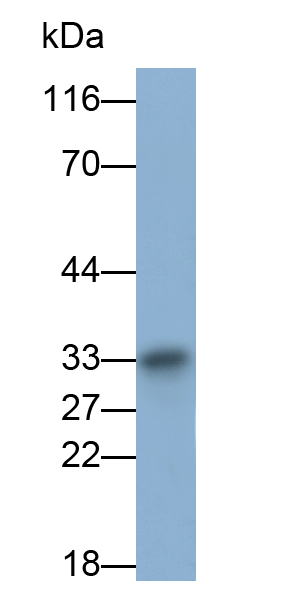 Monoclonal Antibody to Mitochondrial Uncoupling Protein 2 (UCP2)