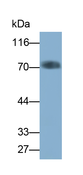 Monoclonal Antibody to Perilipin 1 (PLIN1)