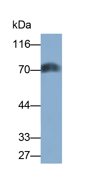 Monoclonal Antibody to Perilipin 1 (PLIN1)