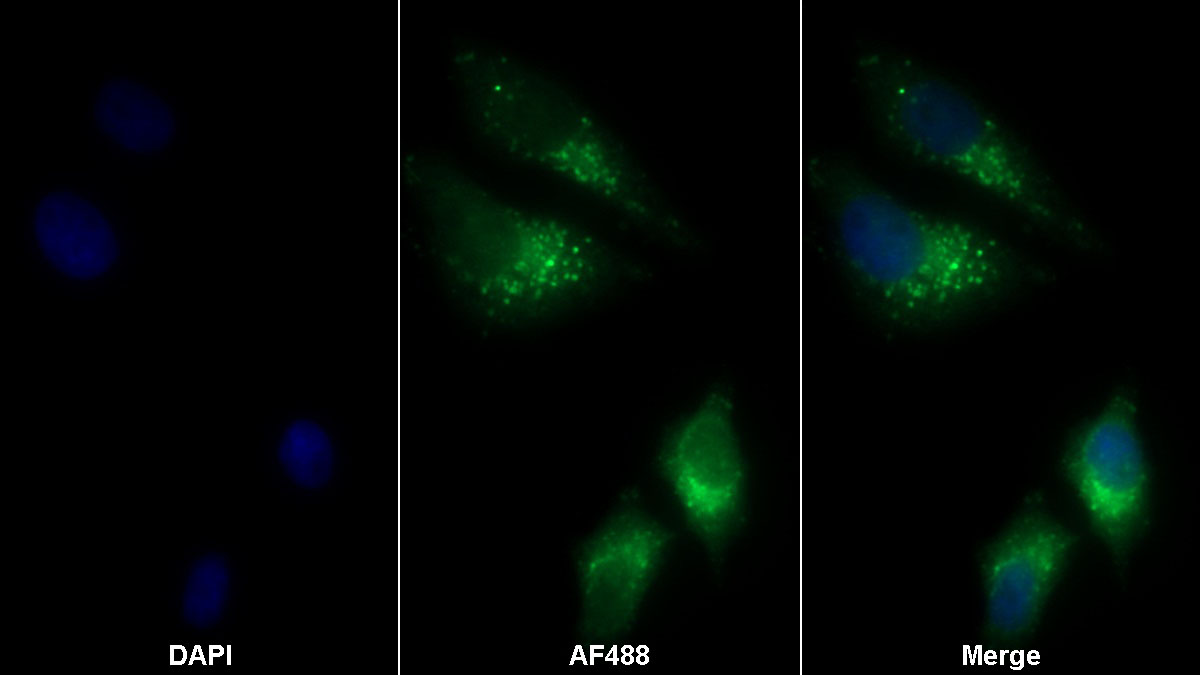 Monoclonal Antibody to Prosaposin (PSAP)