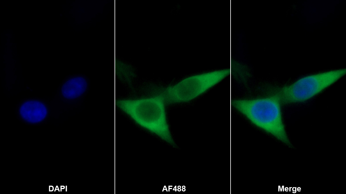 Monoclonal Antibody to Ryanodine Receptor 1, Skeletal (RYR1)