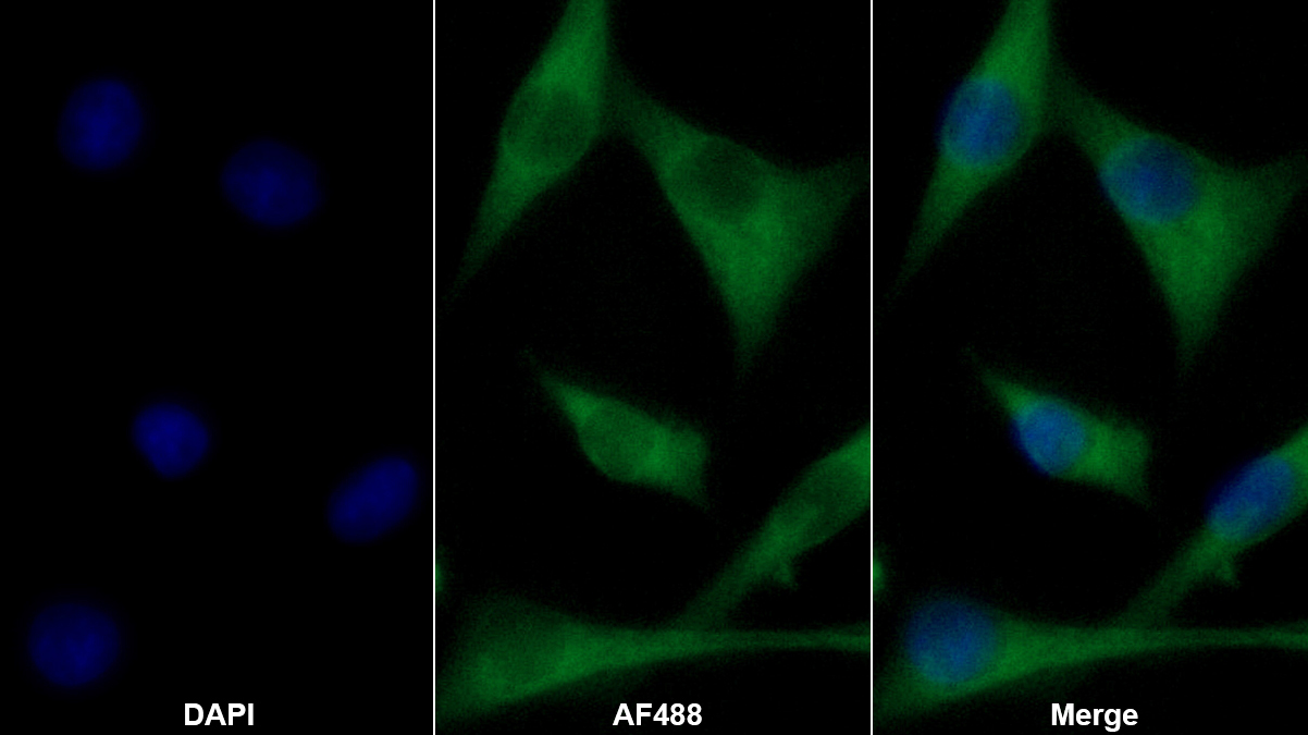 Monoclonal Antibody to Ryanodine Receptor 1, Skeletal (RYR1)