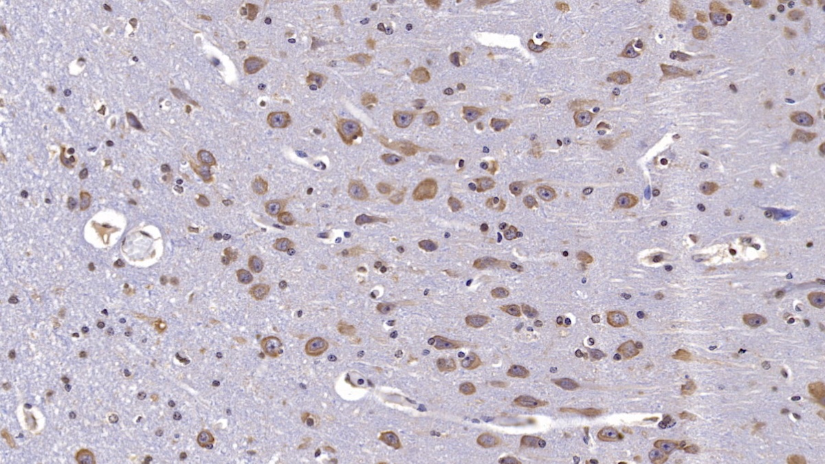 Monoclonal Antibody to Reelin (RELN)