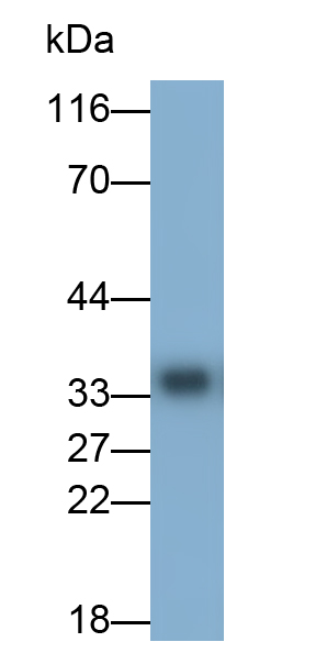 Monoclonal Antibody to Retinaldehyde Binding Protein 1 (RLBP1)