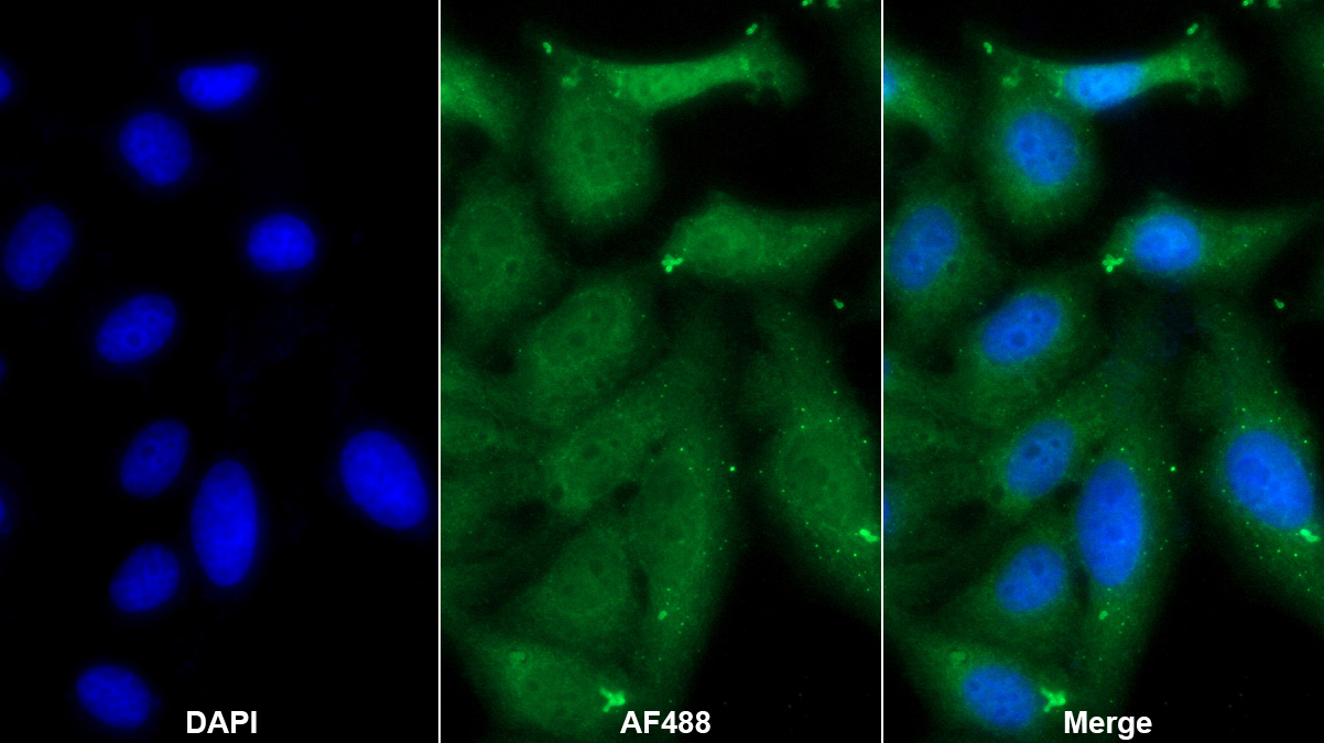 Monoclonal Antibody to Tumor Susceptibility Gene 101 (TSG101)