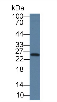 Monoclonal Antibody to Thymidine Kinase 1, Soluble (TK1)