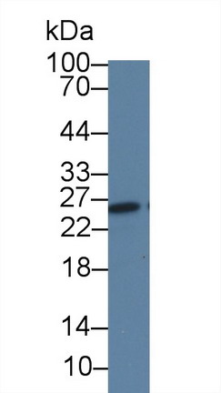 Monoclonal Antibody to Thymidine Kinase 1, Soluble (TK1)